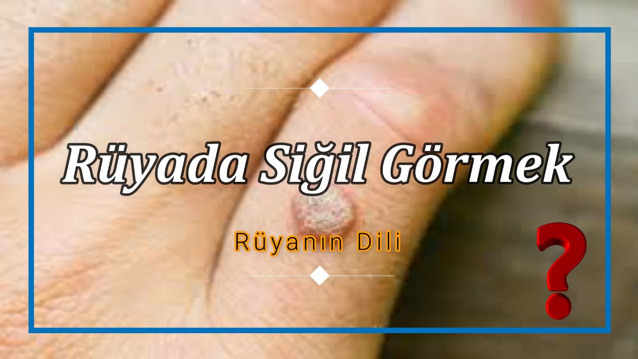 RÜYADA SİĞİL GÖRMEK (rüya tabiri) - YouTube