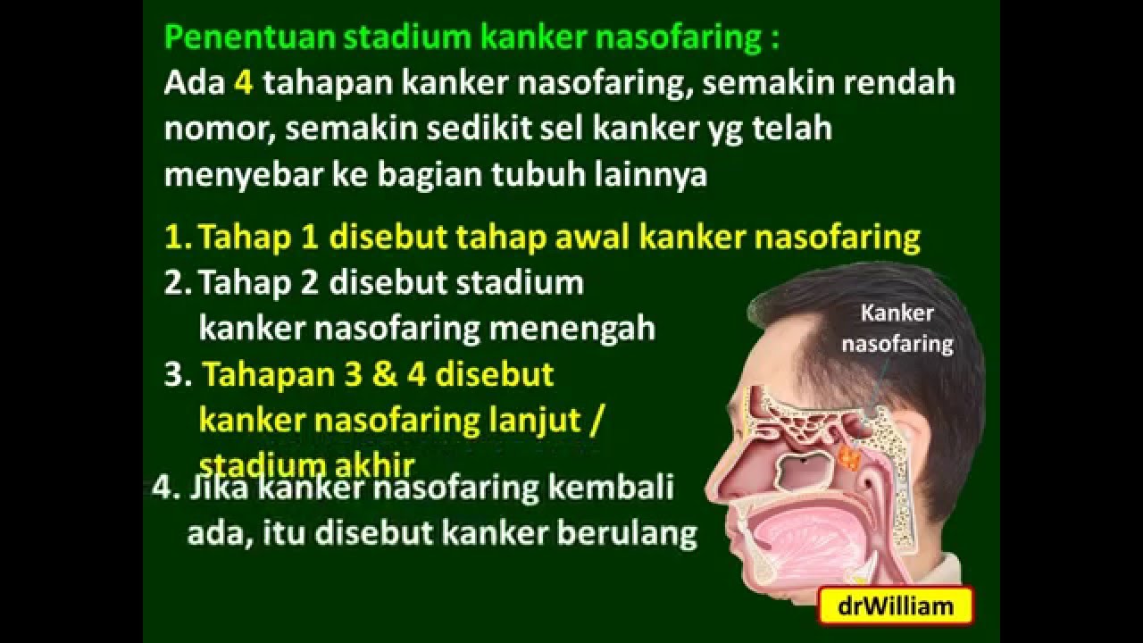Kanker Nasofaring Kanker Nasofaring