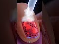 FINALLY Fix Yellow Nails! The NATURAL Secret Is OUT! 🌿 #NailFungus #NaturalRemedy #HealthTips