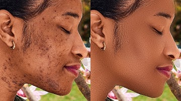 High-End Skin Retouching Beginner Photoshop Tutorial | Frequency Separation