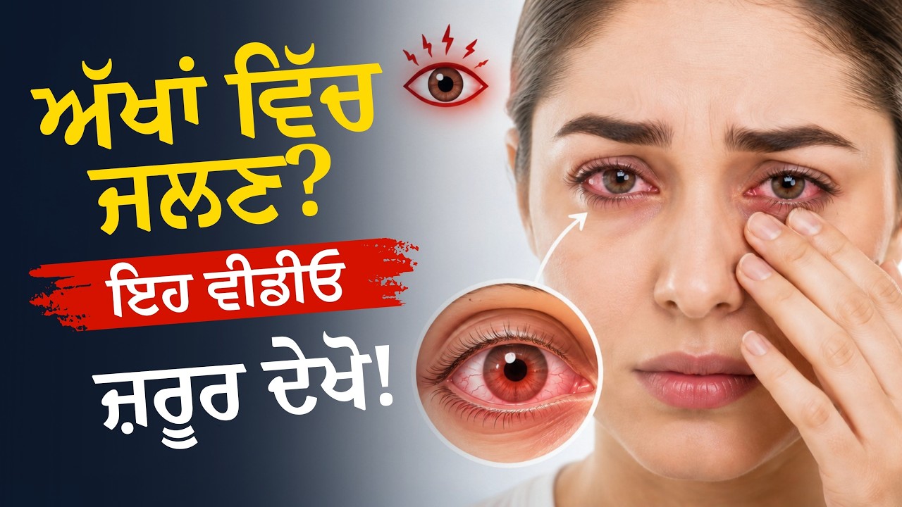 Dry Eye Syndrome ਕੀ ਹੈ? | ਅੱਖਾਂ ਦੇ ਸੁੱਕੇਪਣ, ਜਲਣ ਅਤੇ ਚੁਭਣ ਦਾ ਸਹੀ ਇਲਾਜ | Mitra Eye Hospital