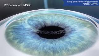 Лазерная коррекция зрения Лазерная коррекция зрения