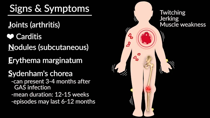 "Acute Rheumatic Fever" by Emmanuel Rusingiza, MD, for OPENPediatrics - DayDayNews