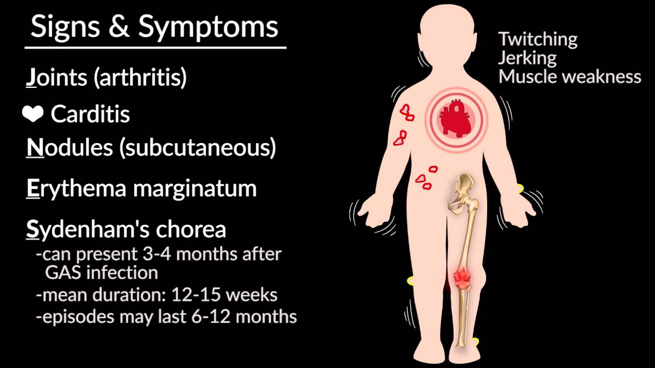 rheumatic fever artroza scleroza articulațiilor cotului