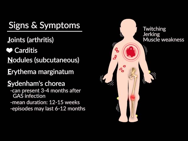 Acute Rheumatic Fever by Emmanuel Rusingiza, MD, for OPENPediatrics class=