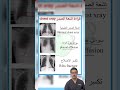 أشعة الصدر كيف يمكن قراءتها اكسبلور ترند  دويتو معلومات 