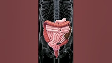 3D Animation of Constipation Explained | Gut Health