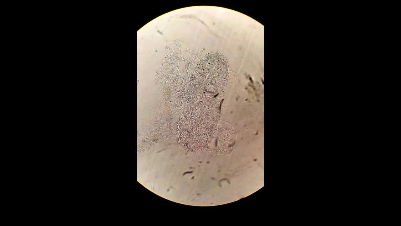 Death of a Paramecium. 3/8/16