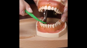 Hướng dẫn vệ sinh răng niềng bằng bàn chải kẽ  #niềngrăng  #orthodontist #niengrang #dentist