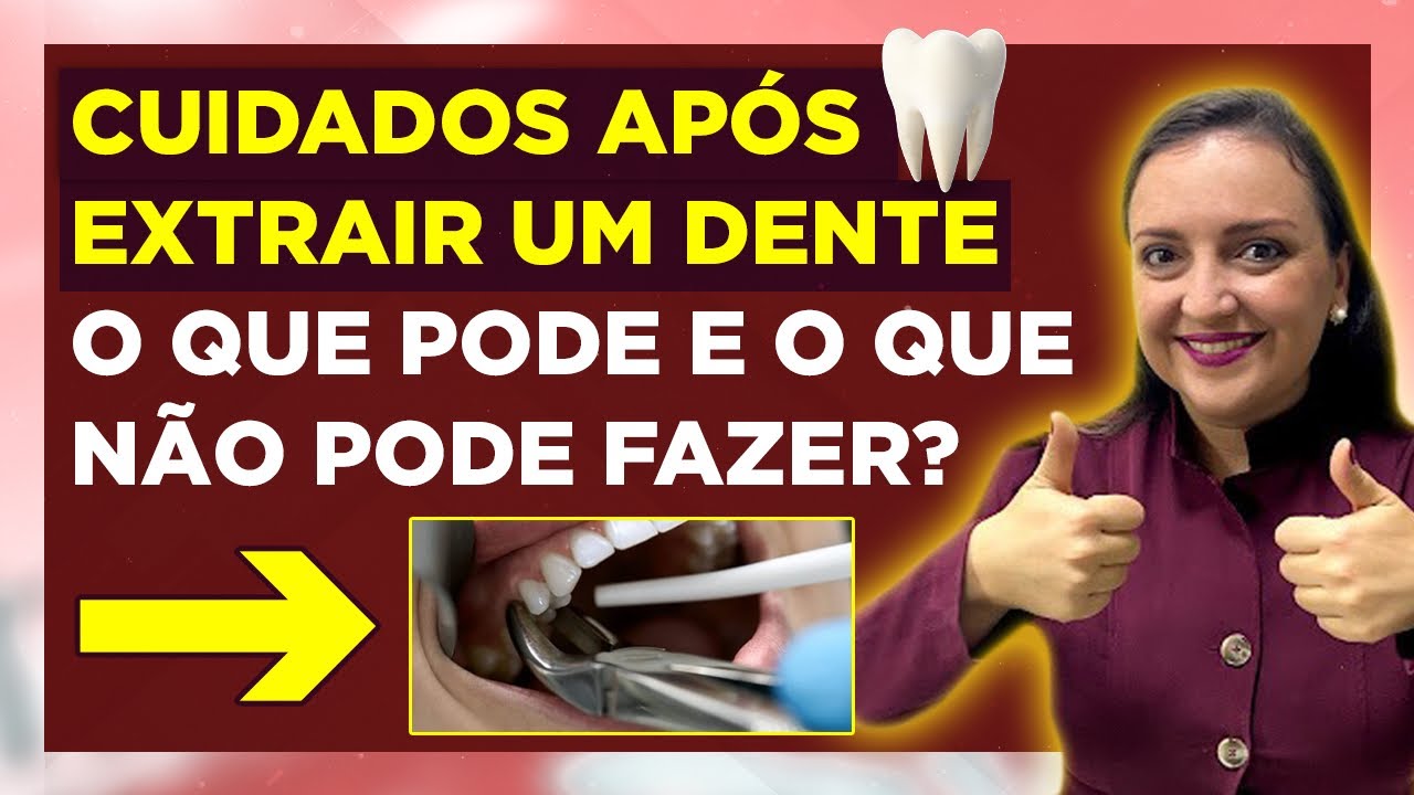 CUIDADOS APÓS EXTRAIR UM DENTE | O QUE PODE E O QUE NÃO PODE FAZER ...