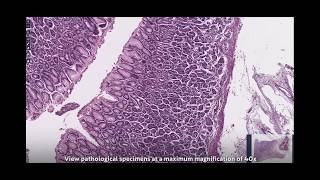 Digital Pathology Ai Analysis Solution Pidportuser Viewer
