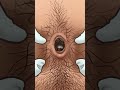 Asmr dirt and stone removal in deep belly button remove huge navel stone animation