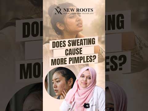 Why You Get Pimples After Sweating | Sweat Acne | Bangla #pimple #bangla #shorts