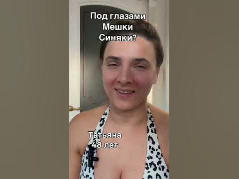 Мешки и синяки под глазами - YouTube