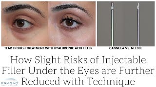 How Slight Risks of Injectable Under Eye Fillers are Further Reduced with Experience and Technique