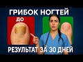 🚫 Грибок кожи и ногтей ИСЧЕЗНЕТ НАВСЕГДА без дорогих мазей | Комплексное лечение грибка
