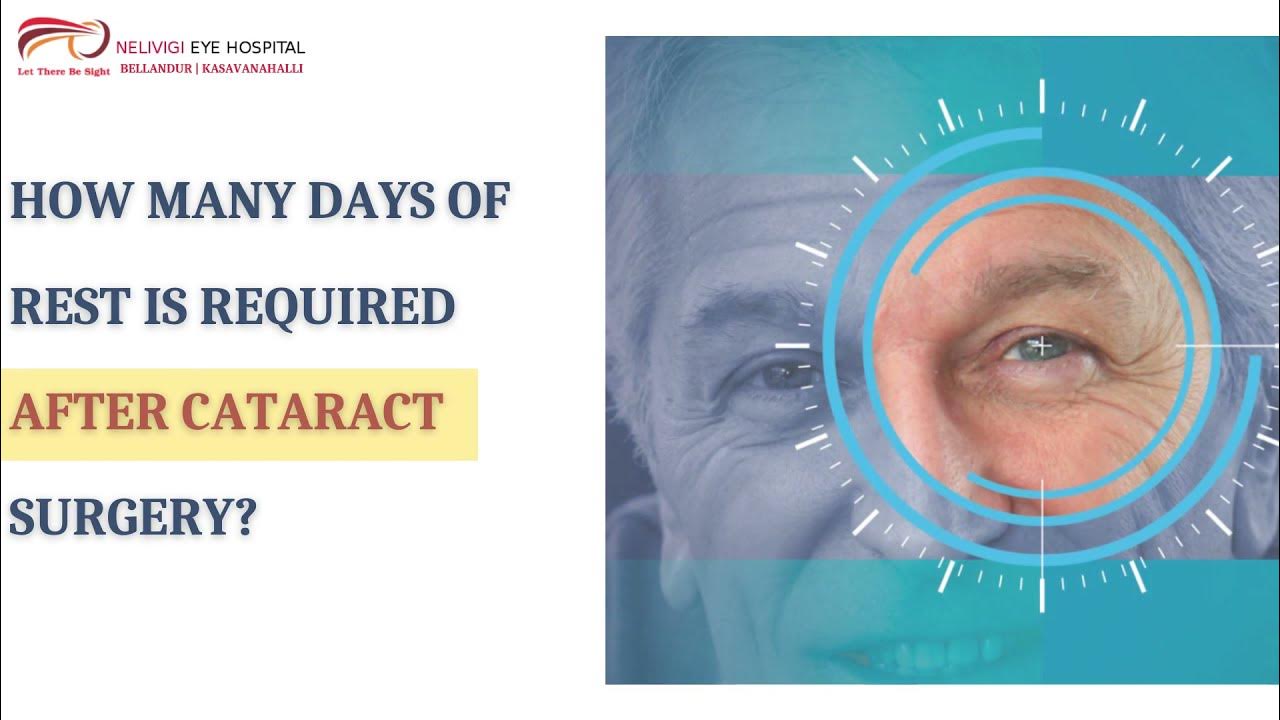 How many days of rest is required after cataract surgery Best Eye Clinics Near Me Nelivigi