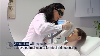 Lumenis Optima Ipl Treatment - Waiting Room Video