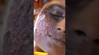 Acid burn face makeup look by Rajkrish.... contact +918884532563 ... Pro makeup course screenshot 2