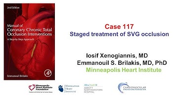 Case 117: Manual of CTO Interventions - Staged SVG revascularization