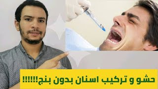 هل يمكن تركيب الاسنان او حشو العصب بدون ابره بنج الاسنان ؟