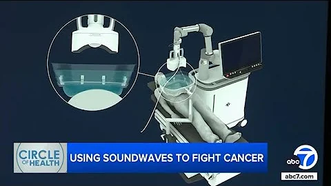 Histotripsy treatment kills cancer cells with sound. Here's how it works
