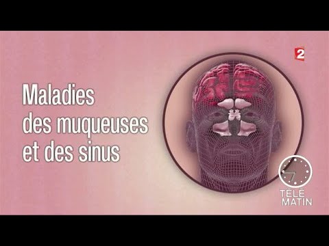 Vidéo: Odeur Derrière Les Oreilles: Causes, Symptômes Et Traitements