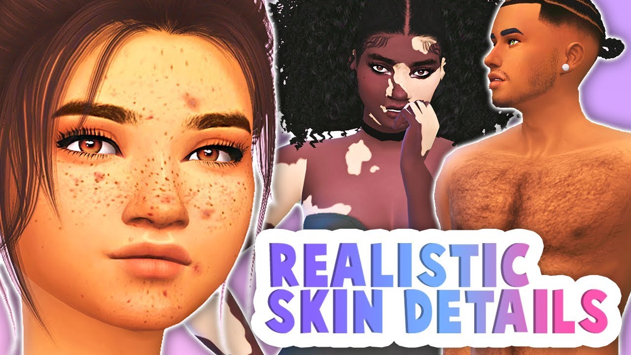 Realistic Skin Details Acne Scars Stretch Marks Vitiligo More The Sims 4 Cc Showcase Youtube - aesthetic fotos de roblox skins tumblr