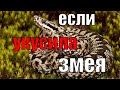 Выживание в лесу I Что делать, если укусила гадюка?