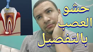 حشو العصب المميزات و العيوب و الطريقه و طرق المحافظه علي حشو العصب