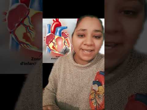 Infarctus du myocarde