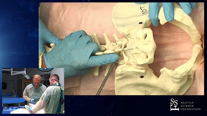 Efficient Posterior Lumbar Decompression Surgery -...