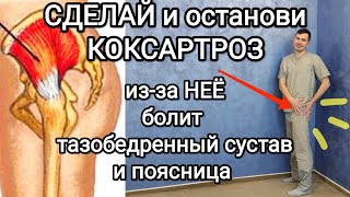 Сделай И Останови Коксартроз / Из-За Этой Мышцы Болит Тазобедренный Сустав И Поясница + Перекос Таза