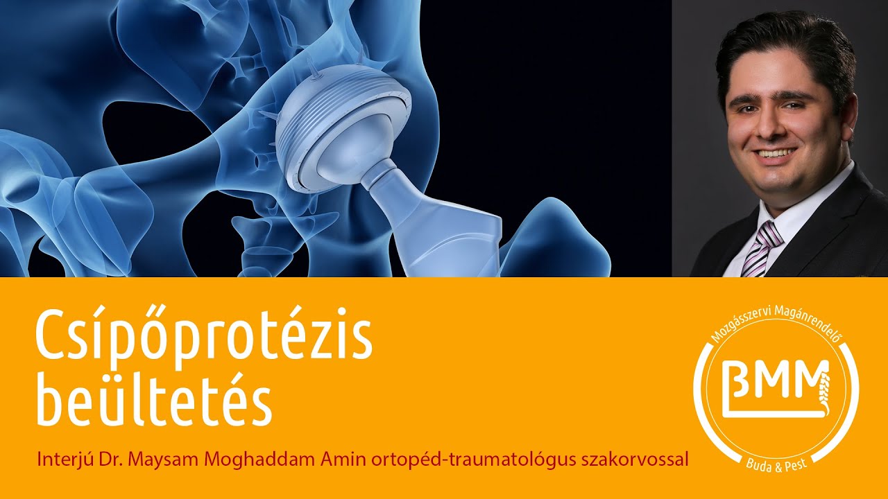 Csípőprotézis beültetés: mennyi idő a gyógyulás?