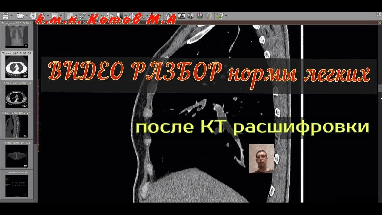 Через сколько делают повторно кт. Как долго расшифровать кт.