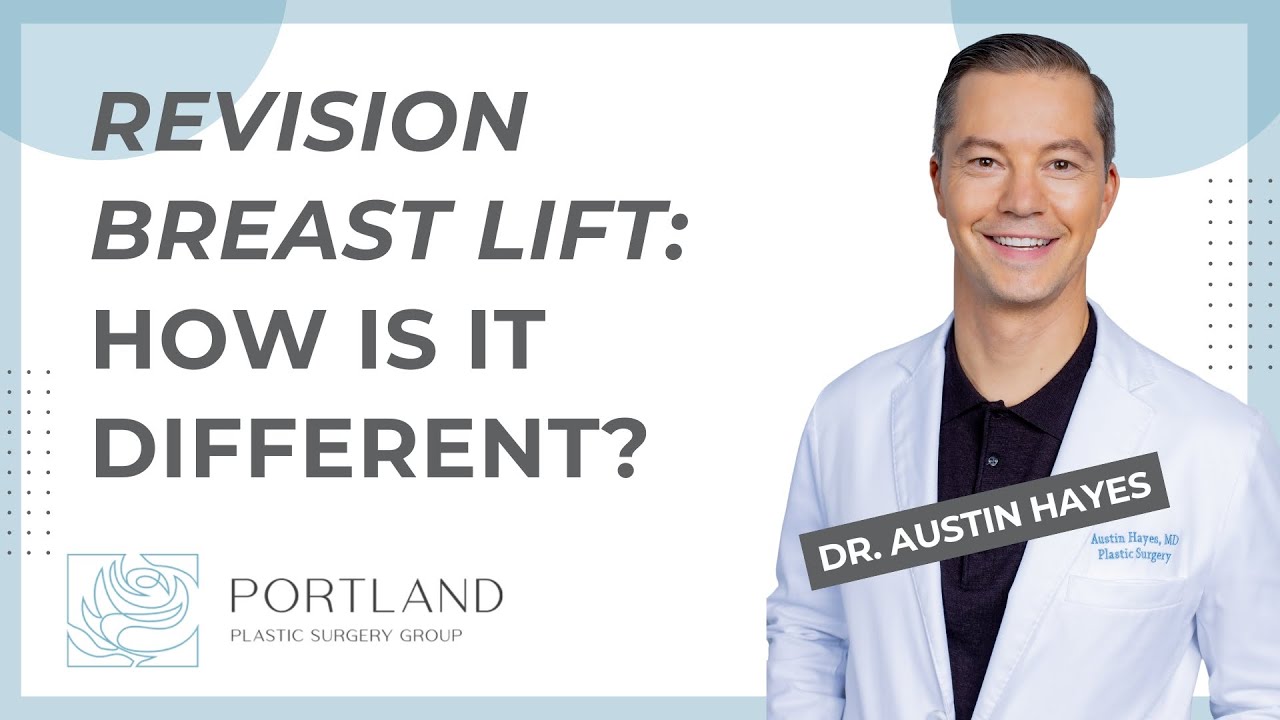 What happens if my breast lift doesn't last?