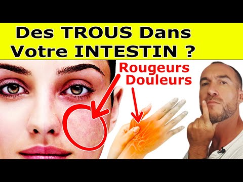 Vidéo: Qu'est-ce qu'un intestin qui fuit ?