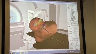 Virtual Experience of a Radiotherapy Treatment Room : Leeds Cancer Centre
