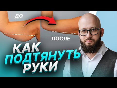 Липосакция рук и плеч (Брахиопластика). Как подтянуть обвисшие руки?