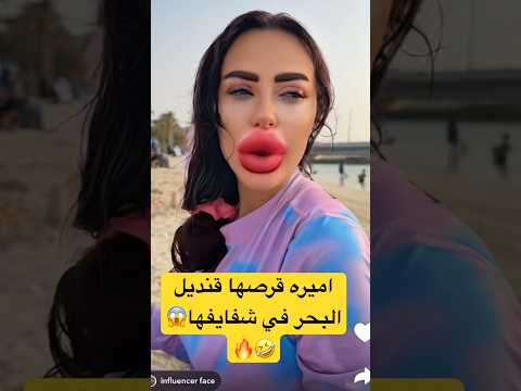 اميره قرصها قنديل البحر في شفايفها عائلة ميرو اميره وعبدالرحمن اكسبلور  ايلين