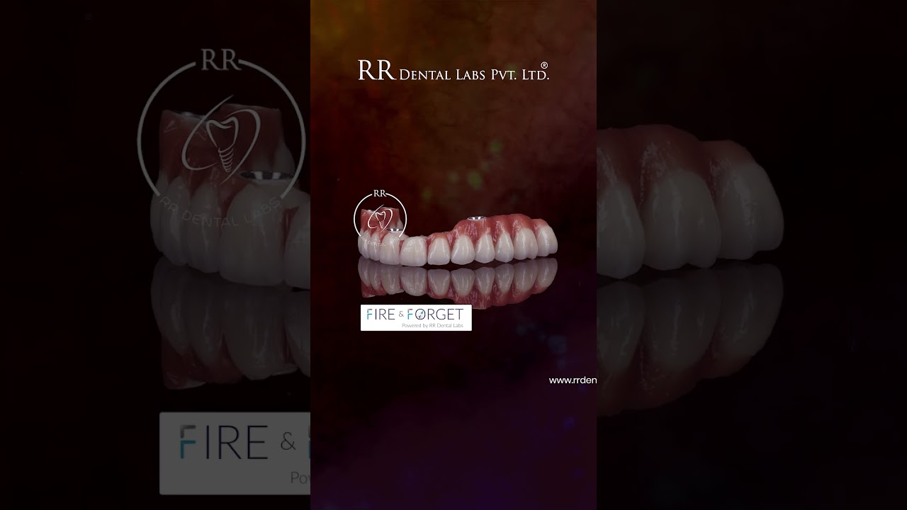 RR Dental Labs  Redefining Dental Innovation | Fire & Forget Implants & I-Dent Aligners