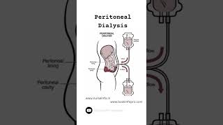 Peritoneal Dialysis #dialysis #peritonealdialysis #trending #viral