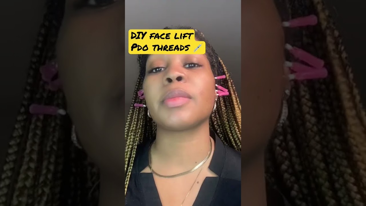 DIY FACE LIFT W/PDO THREADS 🧵 Dissolvable Sutures 