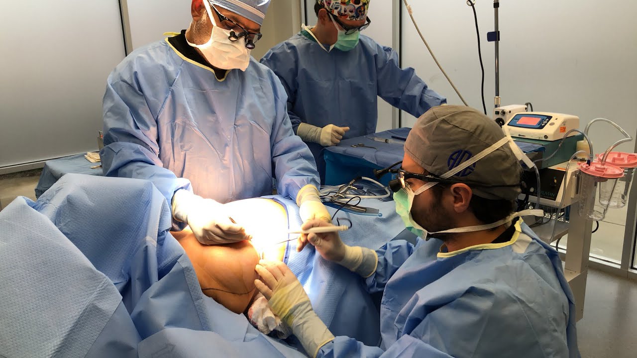 Breast implant removal and replacement near me dr latin heat youtube