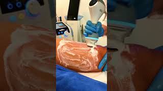 😍✨ Smoother Skin Is Closer Than You Think  | Elite Style Polyclinic Dubai
