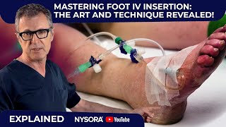 Mastering IV Insertion in the Foot: Key Techniques for Success