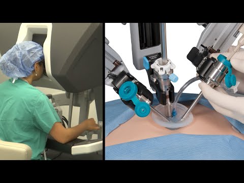 USA Health surgical oncologist performs first robotic liver resection in south Alabama