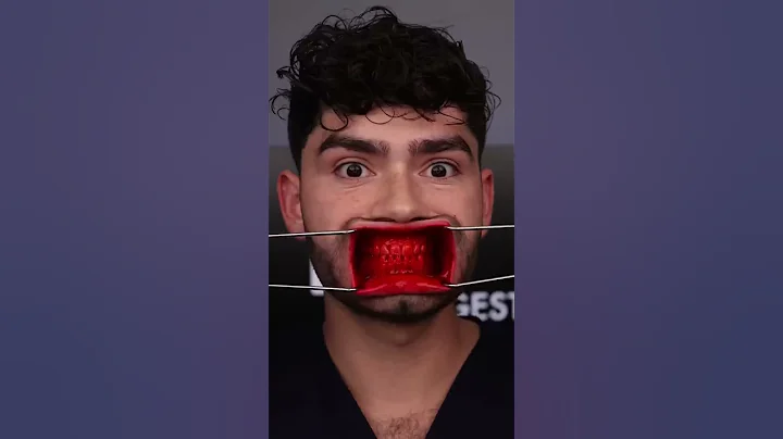 Cursed Candies vs Cavities !?