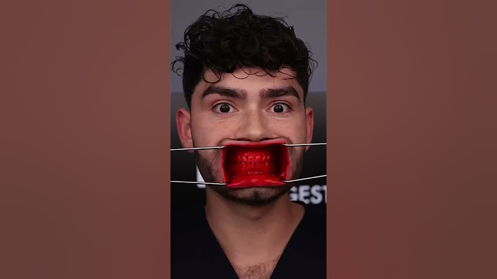 Cursed Candies vs Cavities !?