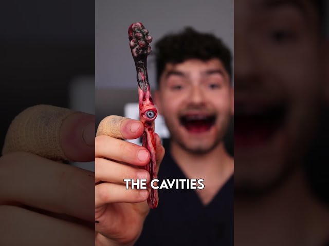 Cursed Candies vs Cavities !? class=
